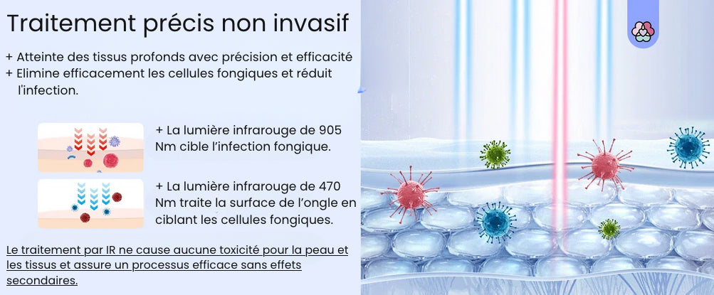NailPulse : Dispositif IR pour traitement fongique des ongles, Elimination de L'onychomycose, Charge USB, Lumière Infrarouge 905Nm (destruction fongique) , Lumière Bleue (désinfection) 470Nm