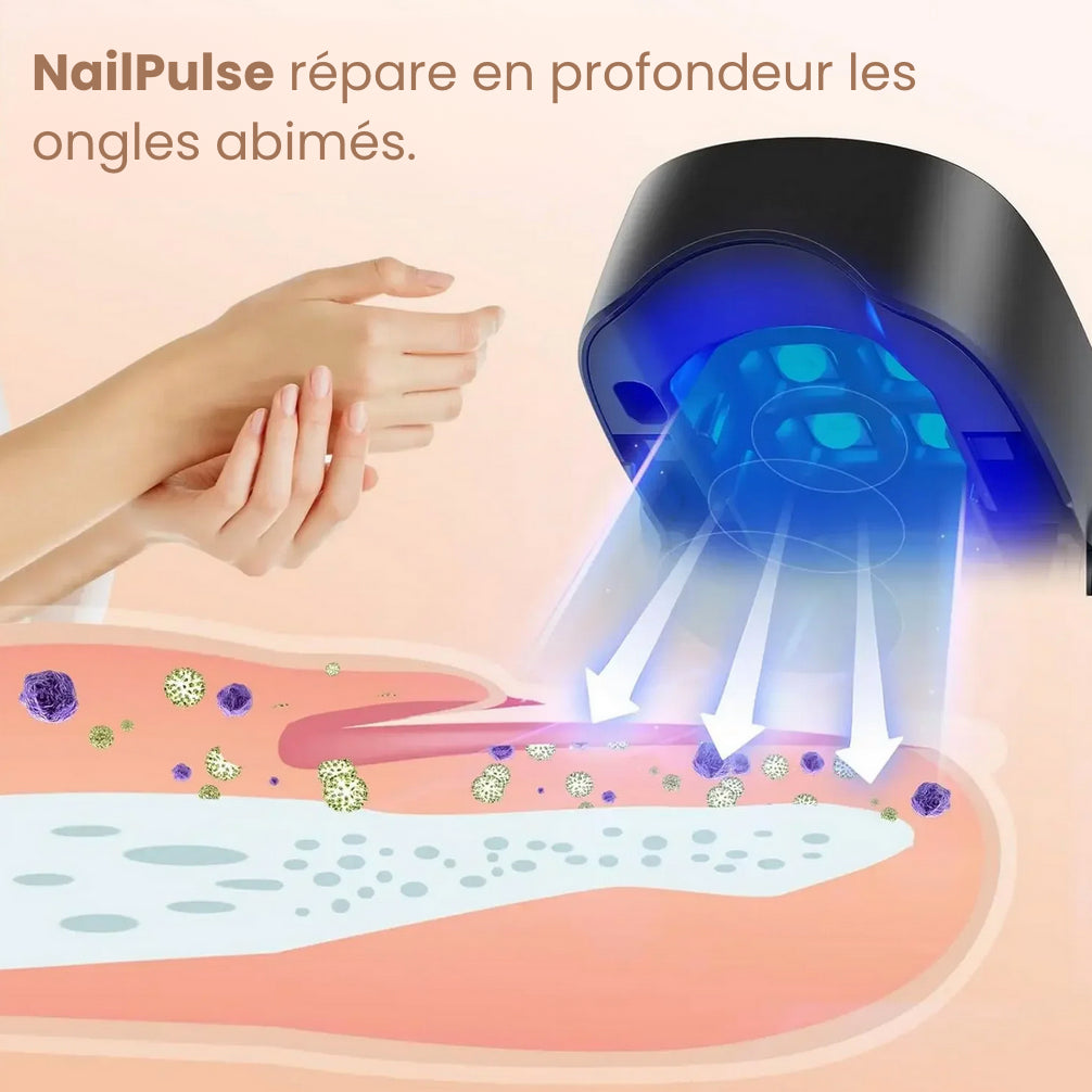 NailPulse : Dispositif IR pour traitement fongique des ongles, Elimination de L'onychomycose, Charge USB, Lumière Infrarouge 905Nm (destruction fongique) , Lumière Bleue (désinfection) 470Nm