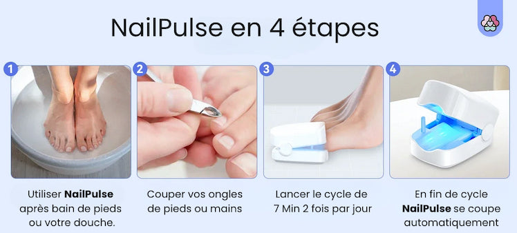 NailPulse : Dispositif IR pour traitement fongique des ongles, Elimination de L'onychomycose, Charge USB, Lumière Infrarouge 905Nm (destruction fongique) , Lumière Bleue (désinfection) 470Nm