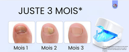 NailPulse : Dispositif IR pour traitement fongique des ongles, Elimination de L'onychomycose, Charge USB, Lumière Infrarouge 905Nm (destruction fongique) , Lumière Bleue (désinfection) 470Nm